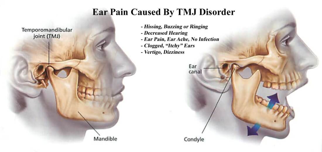 wastafel Verplaatsing uitglijden Ear Pain & Ringing - Head Pain Institute