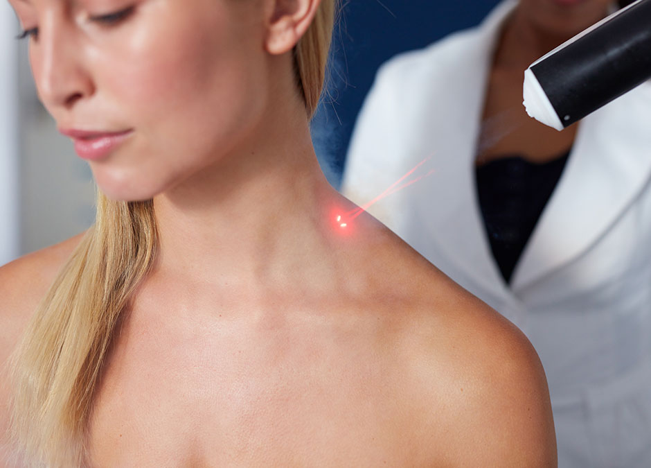 Why Cold Laser Treatment is better than Painkillers for Migraines?
