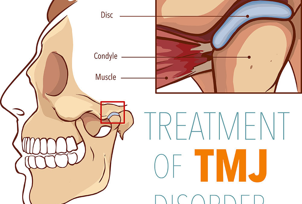 Why You Shouldn’t Postpone Getting TMJ Treatment