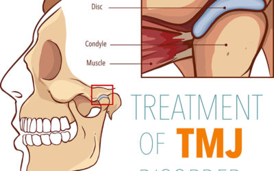 Why You Shouldn’t Postpone Getting TMJ Treatment