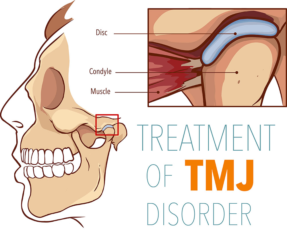 Why-You-Shouldn't-Postpone-Getting-TMJ-Treatment